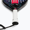 Pádlová raketa Babolat Contact black/blue 150115 4
